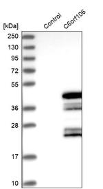 CF106 Antibody in Western Blot (WB)
