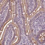 CF106 Antibody in Immunohistochemistry (Paraffin) (IHC (P))