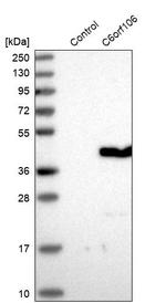 CF106 Antibody in Western Blot (WB)