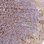 EFHC2 Polyclonal Antibody