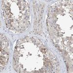 PLEKHA3 Antibody in Immunohistochemistry (IHC)