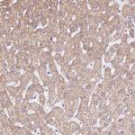 ERAP2 Polyclonal Antibody