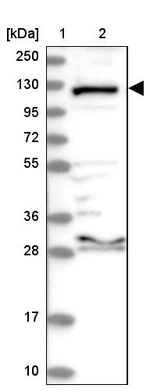 ERAP2 Antibody in Western Blot (WB)