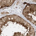 PPP1R7 Antibody in Immunohistochemistry (Paraffin) (IHC (P))