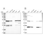 PPP1R7 Antibody in Western Blot (WB)