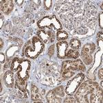 PPP1R7 Polyclonal Antibody