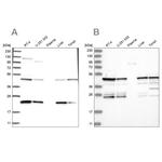 PPP1R7 Antibody in Western Blot (WB)