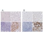 CTRL Polyclonal Antibody