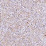 CTRL Antibody in Immunohistochemistry (IHC)