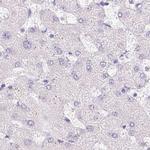 CTRL Antibody in Immunohistochemistry (IHC)