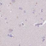 CTRL Antibody in Immunohistochemistry (IHC)