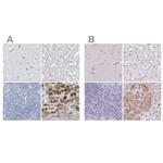 CTRL Polyclonal Antibody