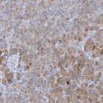 CTRL Antibody in Immunohistochemistry (IHC)