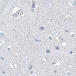 CTRL Antibody in Immunohistochemistry (IHC)