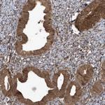 MAPK1IP1L Antibody in Immunohistochemistry (Paraffin) (IHC (P))