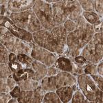 MAPK1IP1L Antibody in Immunohistochemistry (Paraffin) (IHC (P))