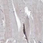 MAPK1IP1L Antibody in Immunohistochemistry (Paraffin) (IHC (P))