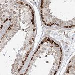 MTMR3 Polyclonal Antibody