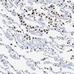Myeloid Specific Antigen Antibody in Immunohistochemistry (Paraffin) (IHC (P))