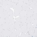 Myeloid Specific Antigen Antibody in Immunohistochemistry (Paraffin) (IHC (P))