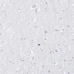 Myeloid Specific Antigen Antibody in Immunohistochemistry (IHC)