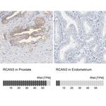 RCAN3 Polyclonal Antibody