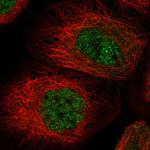 MSL3 Polyclonal Antibody