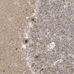 MSL3 Antibody in Immunohistochemistry (Paraffin) (IHC (P))