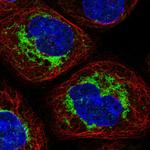 SAMM50 Polyclonal Antibody