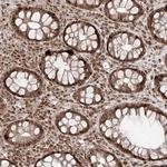 SNRNP27 Antibody in Immunohistochemistry (Paraffin) (IHC (P))