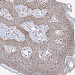 SNRNP27 Antibody in Immunohistochemistry (Paraffin) (IHC (P))