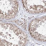SNRNP27 Antibody in Immunohistochemistry (Paraffin) (IHC (P))