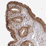 SNRNP27 Antibody in Immunohistochemistry (IHC)