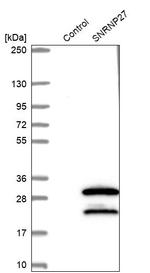 SNRNP27 Antibody in Western Blot (WB)