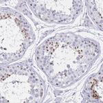 TGIF2LX Antibody in Immunohistochemistry (Paraffin) (IHC (P))