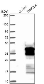 TGIF2LX Antibody in Western Blot (WB)