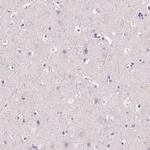 RNF186 Antibody in Immunohistochemistry (Paraffin) (IHC (P))