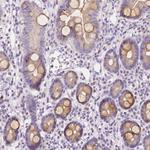 RNF186 Polyclonal Antibody