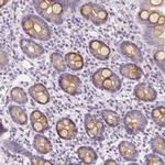 RNF186 Antibody in Immunohistochemistry (IHC)