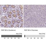 RNF186 Antibody