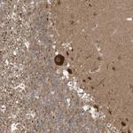 CARF Polyclonal Antibody