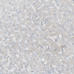 KCC3 Antibody in Immunohistochemistry (Paraffin) (IHC (P))