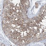 KCC3 Antibody in Immunohistochemistry (Paraffin) (IHC (P))