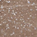 Synapsin 3 Antibody in Immunohistochemistry (Paraffin) (IHC (P))