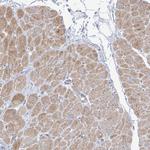 FAM184A Antibody in Immunohistochemistry (Paraffin) (IHC (P))