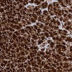 PPEF1 Polyclonal Antibody