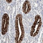 Mammaglobin B Antibody in Immunohistochemistry (Paraffin) (IHC (P))