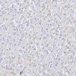 Mammaglobin B Antibody in Immunohistochemistry (Paraffin) (IHC (P))