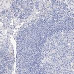 Mammaglobin B Polyclonal Antibody