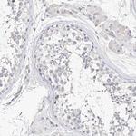 Mammaglobin B Antibody in Immunohistochemistry (IHC)